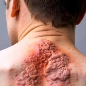 Serious Diseases Diagnosed Via Skin Signals