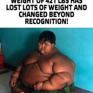 “Nothing Is Impossible”: The Fattest Boy With A Weight Of 421 lbs Has Lost Lots Of Weight And Changed Beyond Recognition!