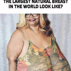 “Her Breasts Weigh 110 lbs”: What Does TheWoman With The Largest Natural Breast In TheWorld Look Like?